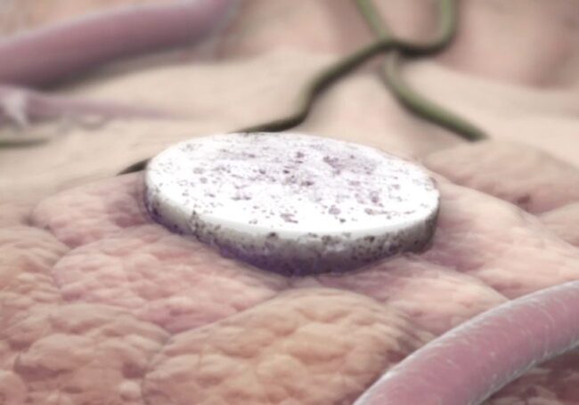 oscabecasdanoticia-vacin.jpg