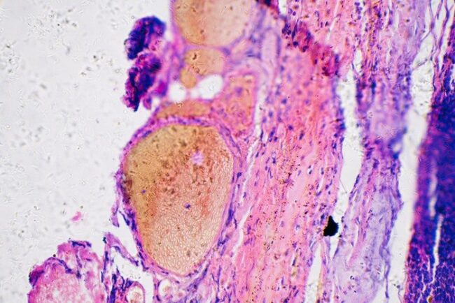 oscabecasdanoticia-e5452.jpg