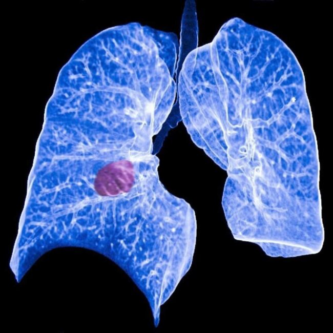 oscabecasdanoticia-cbnfo.jpg