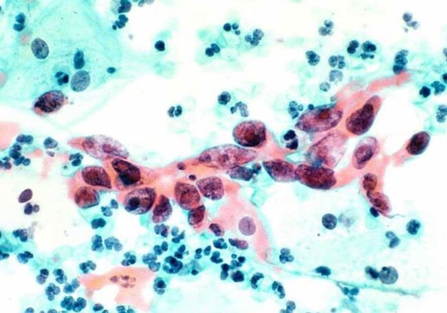oscabecasdanoticia-laser.jpg
