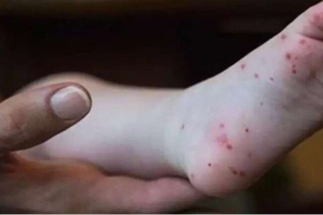 oscabecasdanoticia-1_mao.jpg