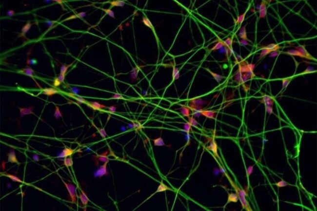 oscabecasdanoticia-1_ste.jpg