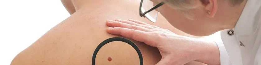oscabecasdanoticia-istoc.webp