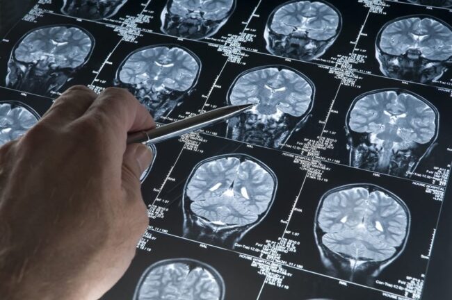 oscabecasdanoticia-getty.jpg