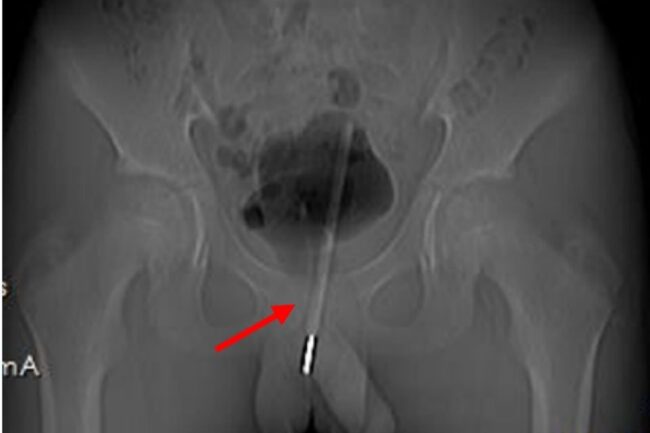 oscabecasdanoticia-termo.jpg