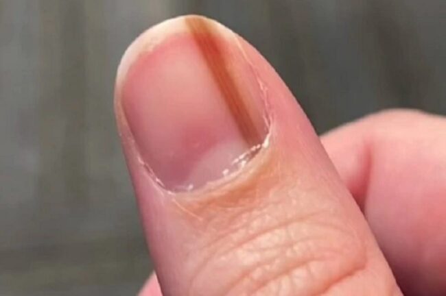 oscabecasdanoticia-a-man.jpg