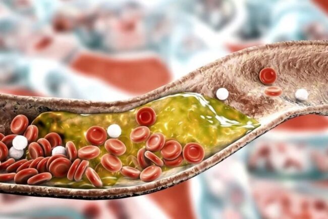 oscabecasdanoticia-coles.jpg
