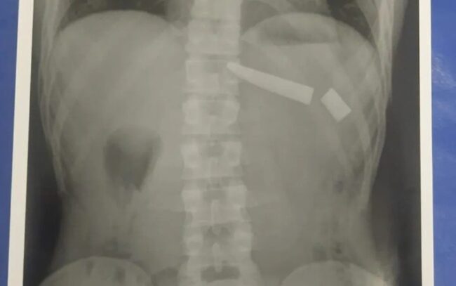oscabecasdanoticia-faca-.jpeg