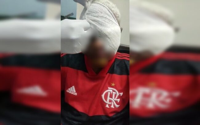 oscabecasdanoticia-jovem.jpeg