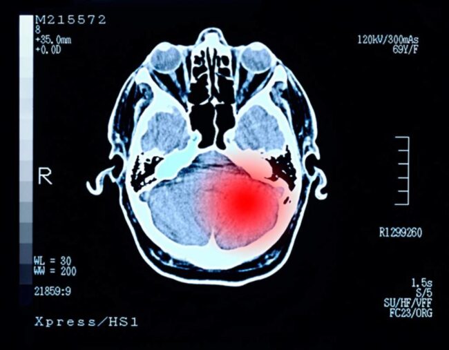 oscabecasdanoticia-getty.jpg