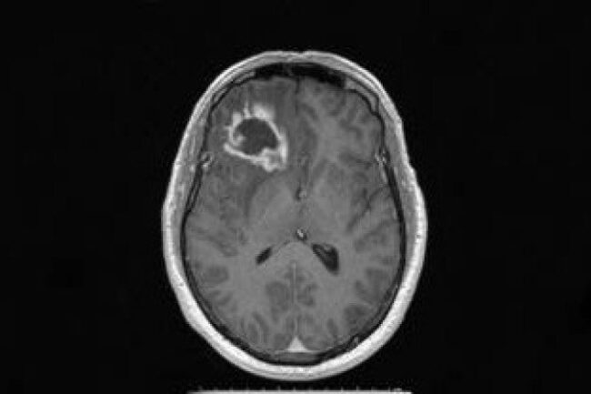 oscabecasdanoticia-1_cbn.jpg