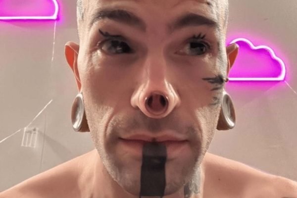 Na foto, homem aparece com a ponta do nariz removido e tatuagens pelo rosto - Metrópoles