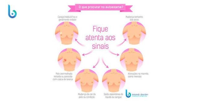 oscabecasdanoticia-image.jpg