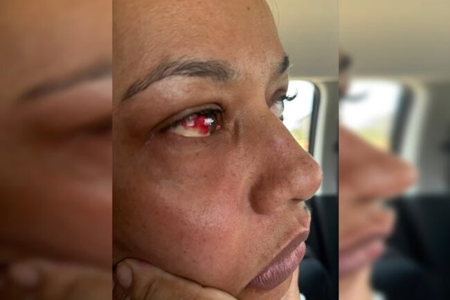 oscabecasdanoticia-mulhe-1 mulher-agredida-luziania-3