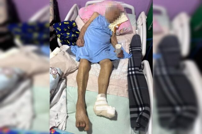 idosa deitada na cama com pé enfaixado