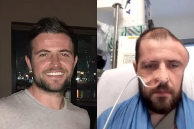 James homem atropelado diz que cérebro girou no crânio (2)