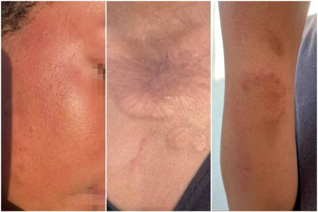 Mae-e-presa-por-torturar-o-filho-de-14-anos