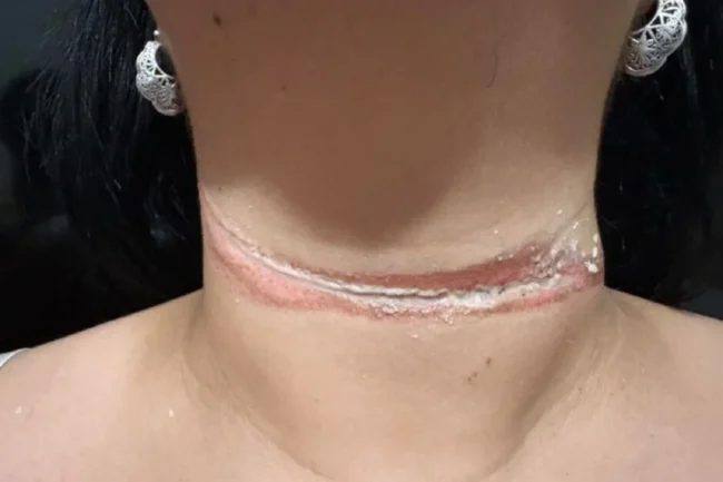 professora-quase-e-enforcada-por-fio-solto