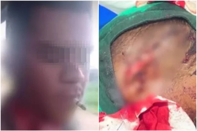 Homem-fuma-apos-ter-orelha-decepada-com-faca-apos-briga