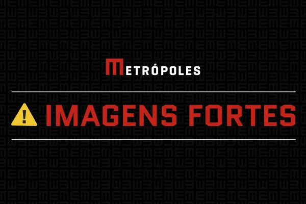 Homem ataca e rasga cabeça de mulher durante festa de 1 ano do filho - destaque galeria Homem ataca e rasga cabeça de mulher durante festa de 1 ano do filho - destaque galeria