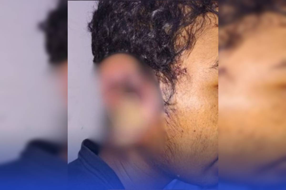 Jovem com infecção parasitária some após sair de hospital no DF - destaque galeria