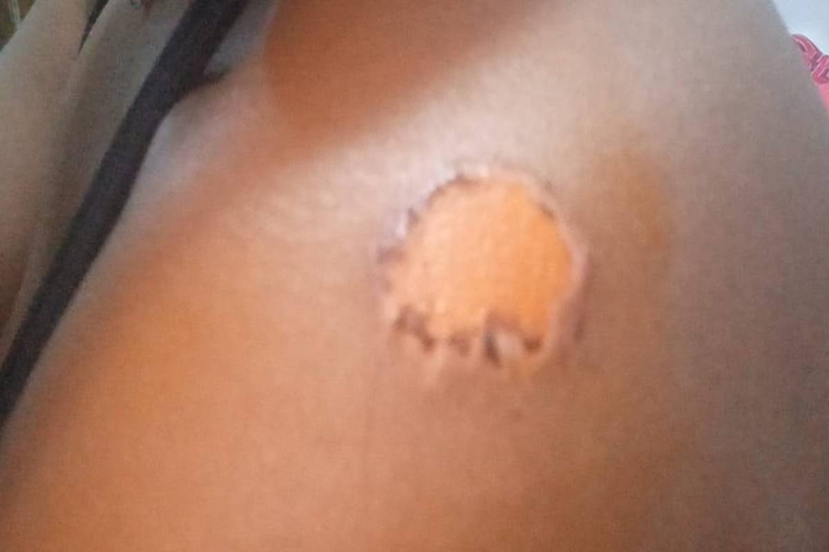 A vítima foi ferida no ombro após cair no asfalto 