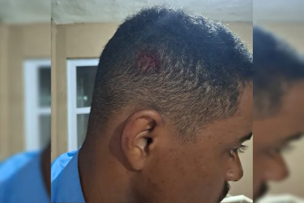 Motorista de ônibus é atropelado por carro elétrico; condutor foge - destaque galeria