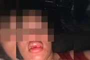 Tapas, socos e enforcamento: vereador é denunciado por agredir mulher - imagem 2