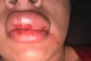 Tapas, socos e enforcamento: vereador é denunciado por agredir mulher - imagem 3