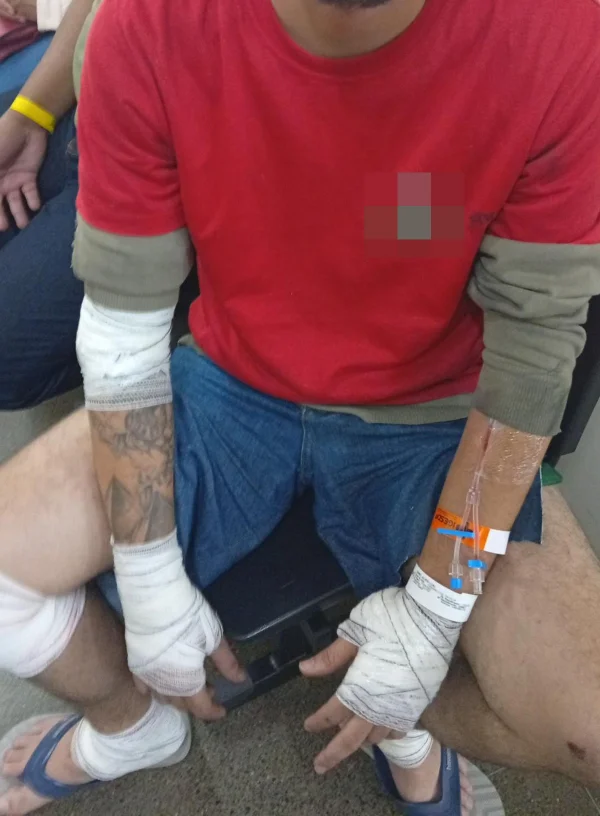 Motorista se irrita com tapa no retrovisor e atropela motociclista no Eixão - destaque galeria