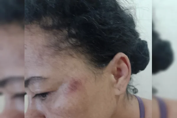 Família denuncia ação truculenta da PM, com gás de pimenta até em bebê - destaque galeria