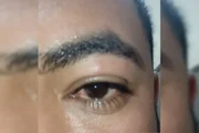 O genro de Aline também sofreu ferimentos em um dos olhos e na perna