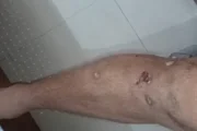 Família denuncia ação truculenta da PM, com gás de pimenta até em bebê - imagem 4