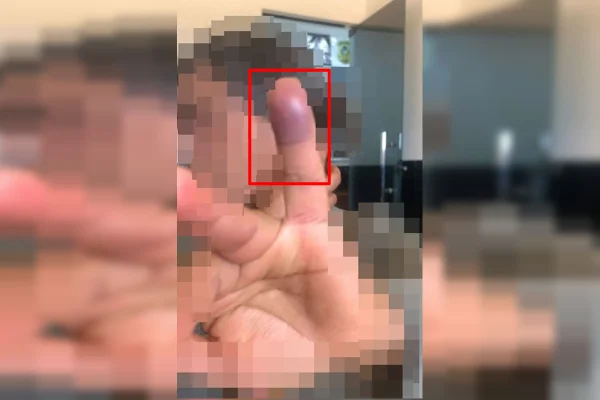 Mulher estrangulada com toalha foi atacada por amigo do filho - destaque galeria