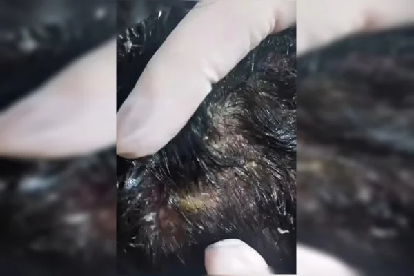 Outra foto da lesão cabeça de uma das crianças
